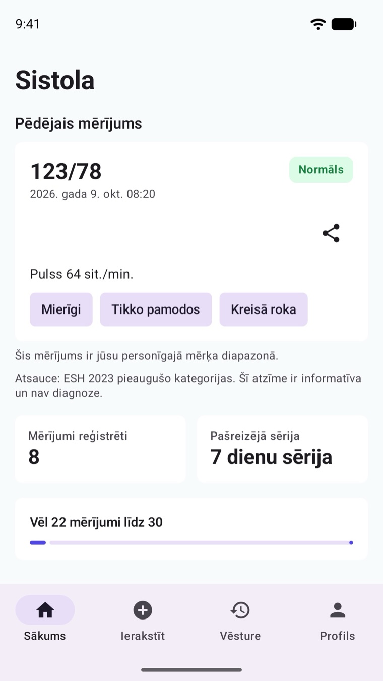 Sistola sākuma skats